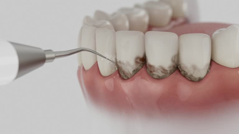 Reliable Tooth Extraction contractor in Mar-Mac, NC by Smile Center Dentistry
